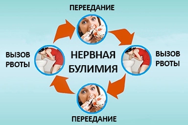 Лечение булимии в Сукко